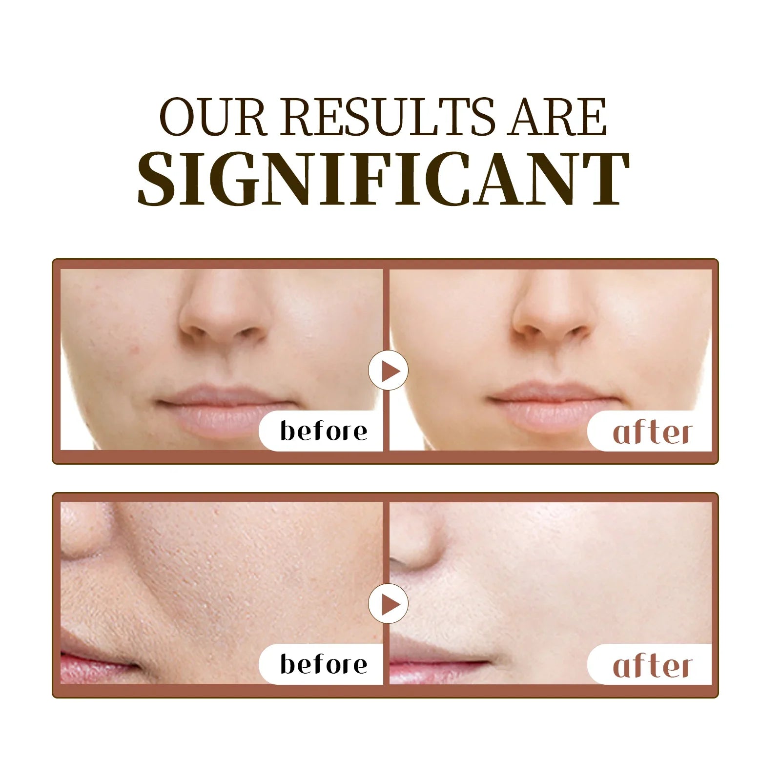S839ae911cb024b19b20ad285c1378b1ed